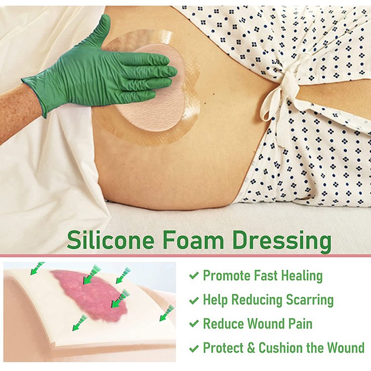 18*18 Bordered High Absorbency Sacrum Wound Healing Dressings Skin Color Silicone Gel Adhesive Foam Dressing