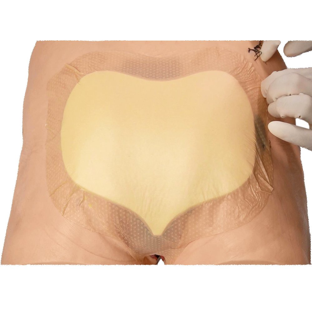 Wound Dressing Sacrum Foam Bandages Silicone Adhesive Border Waterproof Sacral Pads Absorbent Bed Sore Pressure Dressing