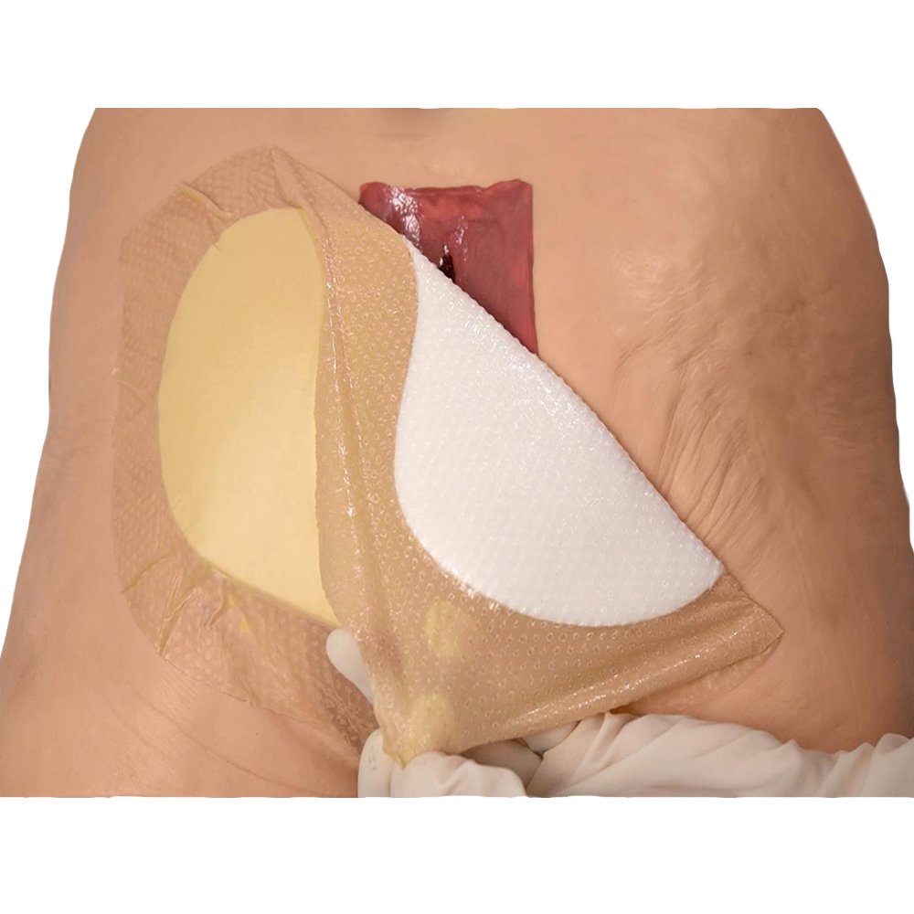 Wound Dressing Sacrum Foam Bandages Silicone Adhesive Border Waterproof Sacral Pads Absorbent Bed Sore Pressure Dressing
