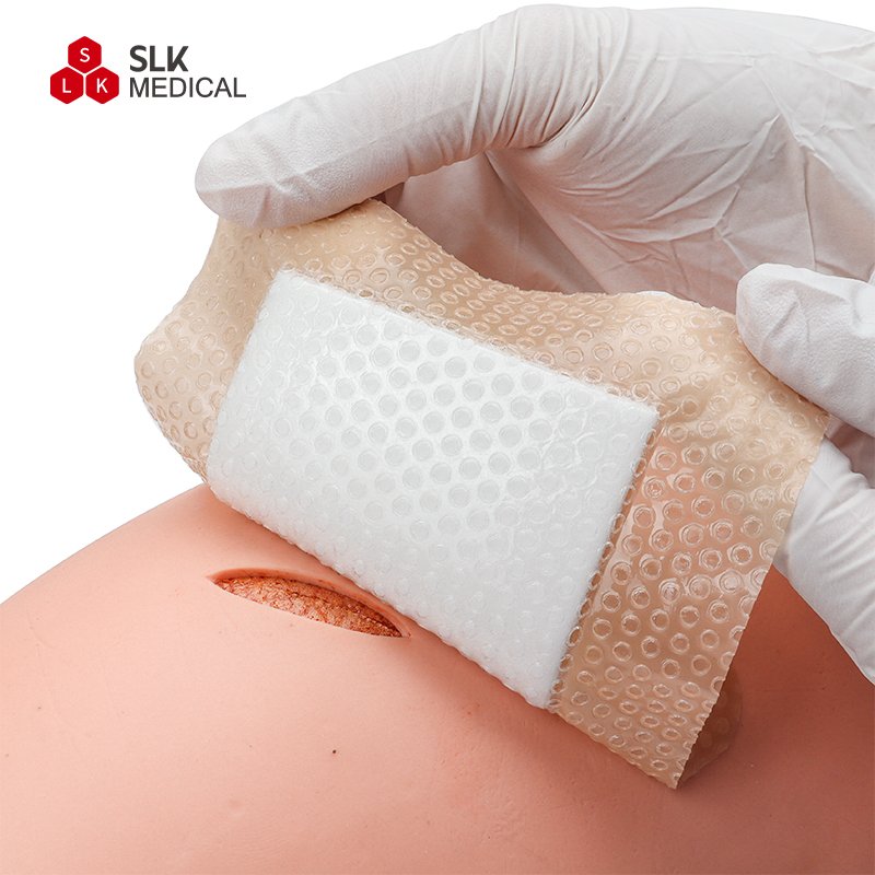 Alexer Manufacture Absorbent Foam Dressing for Pressure Ulcers Wounds Silicone Foam Dressing