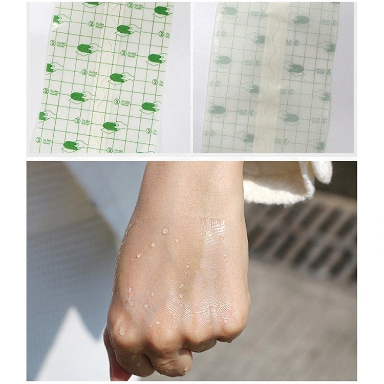 Ce Approved Medical Sterile Packing Non Woven Medical Adhesive Wound Dressing