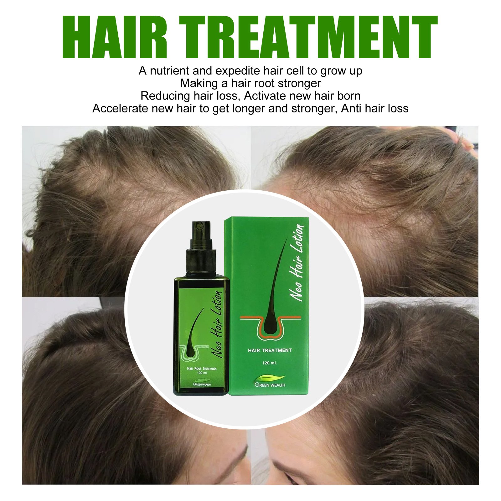 Hair growth serum nourishes the scalp, nourishes hair roots and prevents falling out Prevents Falling Out Growth Oil Treatment