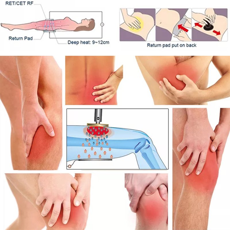 Ret Cet Rf Tecar Shortwave Diathermy Physiotherapy Pain Relief Smart Indiba Tecartherapy Machine Fisioterapia Y Rehabilitacio