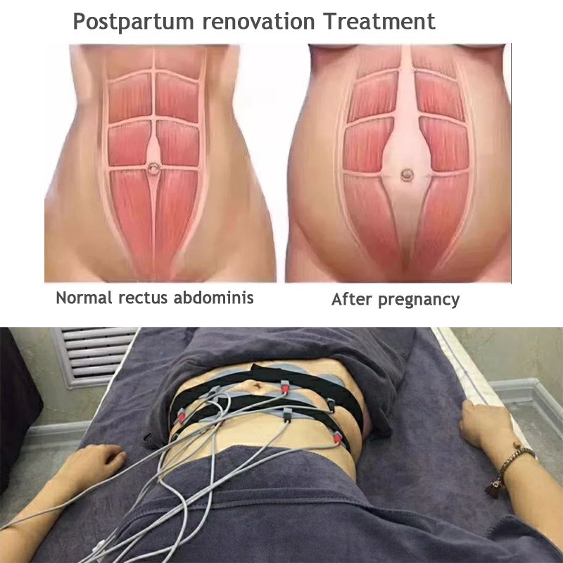 Au-800S Electro Muscle Stimulator Postpartum Repair Electroestimulacio Russian Waves Myostimulation Machine