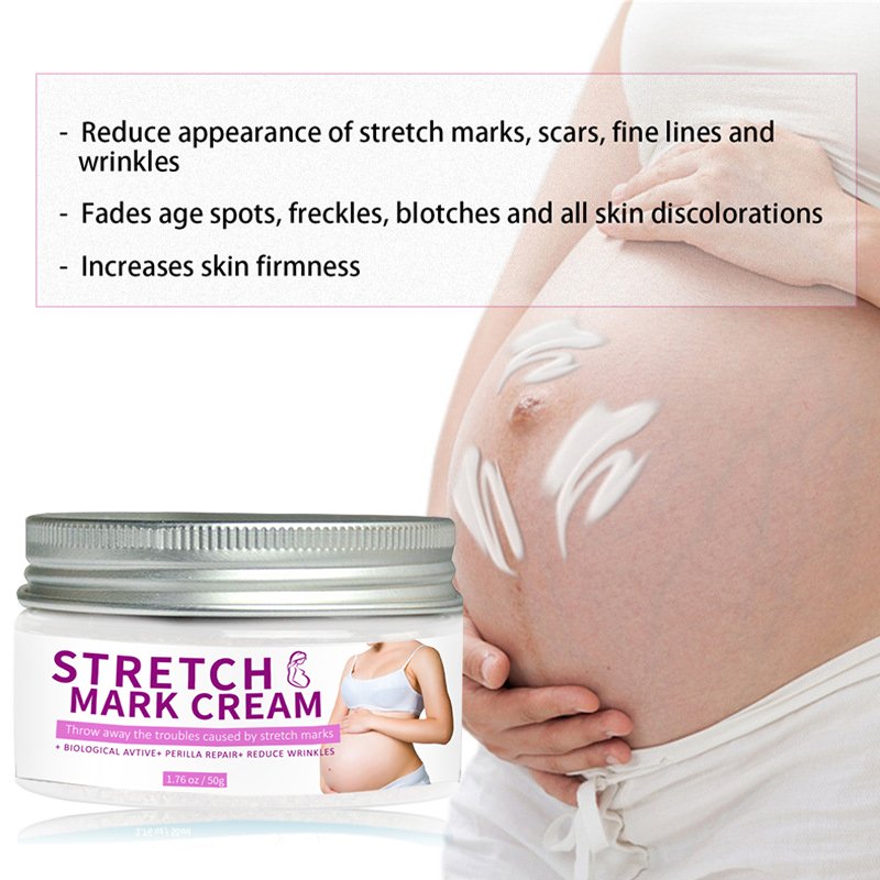 OEM/ODM 50g High Quality Strong Stretch Marks Remover Skin Repair Cream Stretch Mark Scar Pregnancy Stretch Mark Cream
