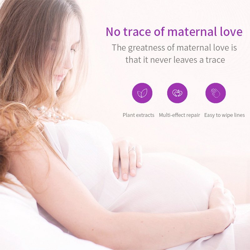 OEM/ODM 50g High Quality Strong Stretch Marks Remover Skin Repair Cream Stretch Mark Scar Pregnancy Stretch Mark Cream