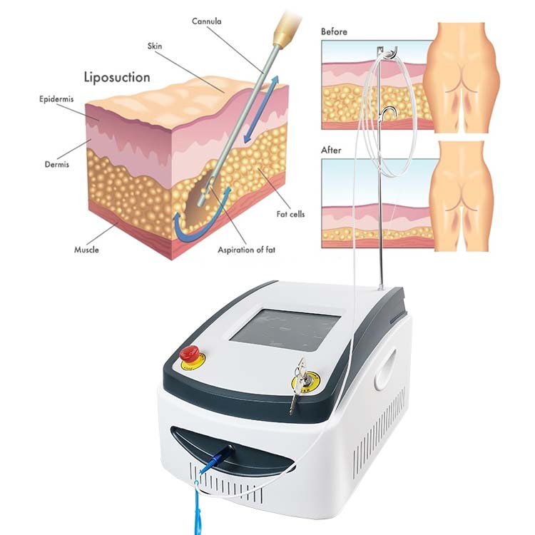 Professional Diode Laser 980nm Lipolysis Machine Portable Vaser Liposuction Weight Loss Surgical Machine