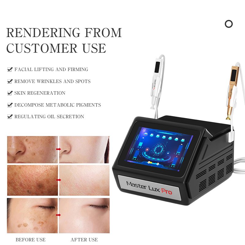 OEM ODM Ozone Plasma 2 in 1 Face Lifting Improve Fine Lines Anti-Aging Scar Tissue Removal Device Cosmetology Equipment