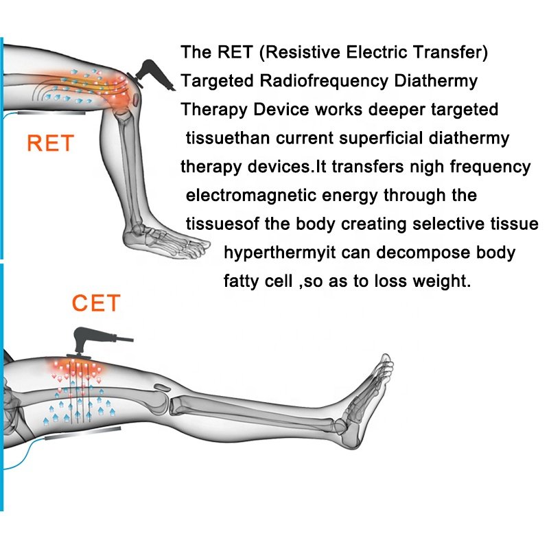 Tecar Physical Therapy Equipment Radiofrequency RF Diathermy CET RET Tensamax for Pain Relief Skin Tightening Fat Removal