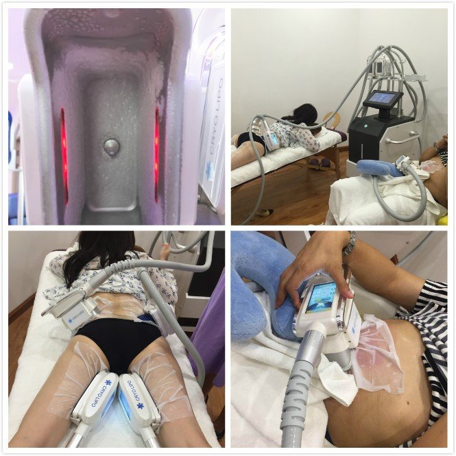 CE Approved Popular Leg Arm Belly Fat Removal Beauty Freeze Weight Loss Machine for Salon