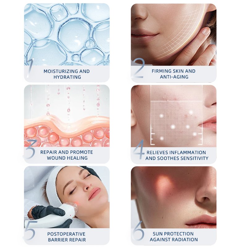 Newcynure Professional Face Care Facial Mask Oil Face Skin Care Mask Medical Grade Sodium Hyaluronate Skin Repair Dressing