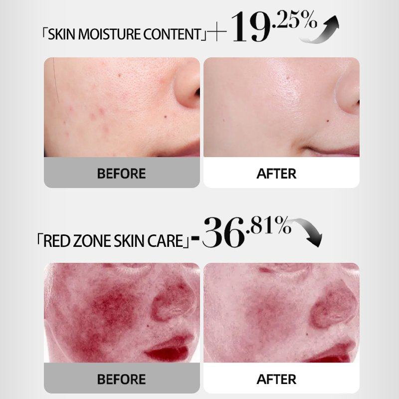 Light Luxury Popular Large Lamp Beauty Device Light Repair Acne Acne Brightening Care Led Optical Skin Beauty Instrument