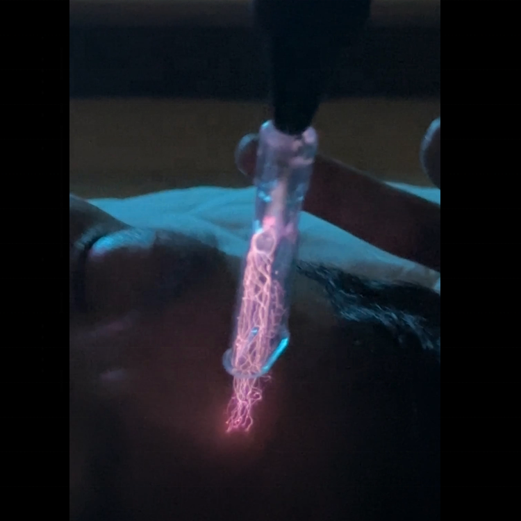 2025 Newest to Cold Plasmo Beauty Device Remove Scars and Anti-aging Plasma Machine