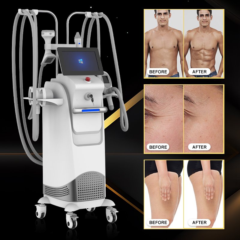 Hongqi Body Contouring Weight Loss Beauty Equipment Vela Slim Machine Vela Body Shaping Cellulitis Removal