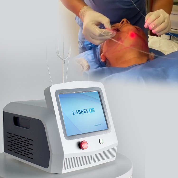 2025 Newest Diode Laser 980nm 1470nm Vaser Liposuction Equipment /lipolisis Body Shaping Slimming Machine