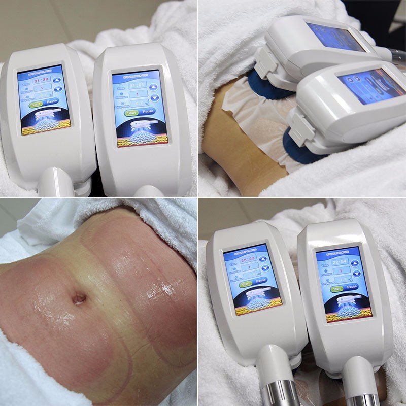 Factory Supply Ce Approved Body Slimming Machine Fat Removal Equipment Weight Loss Device for Beauty Center