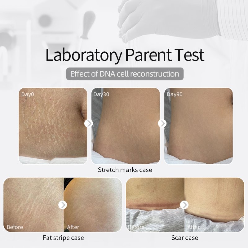 Effective Scar Removal Stretch Marks Remove Cream Smoothing Firming Anti Stretch Marks Scar Repair Cream