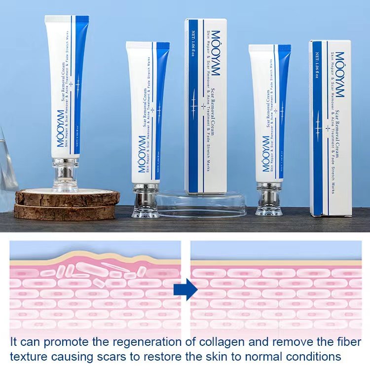 Effective Scar Removal Face Cream Acne Pimples Stretch Marks Remove Gel Smoothing Firming Anti Stretch Marks Scar Repair Cream