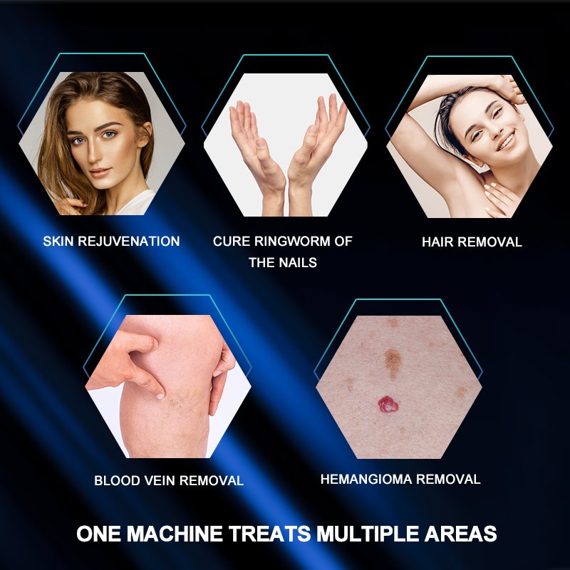 Alexandrite Alex Nd Yag Long Pulse Laser Hair Removal Machine Digital Face Body Epilation UK/US/EU/ZA Includes Skin Rejuvenation