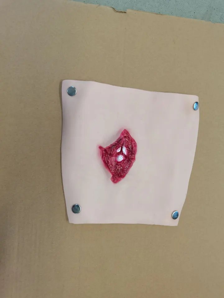 Medical Sciences Advanced Wound Care Model Simulates Traumatic Arm Muscle Bleeding Experimental Device