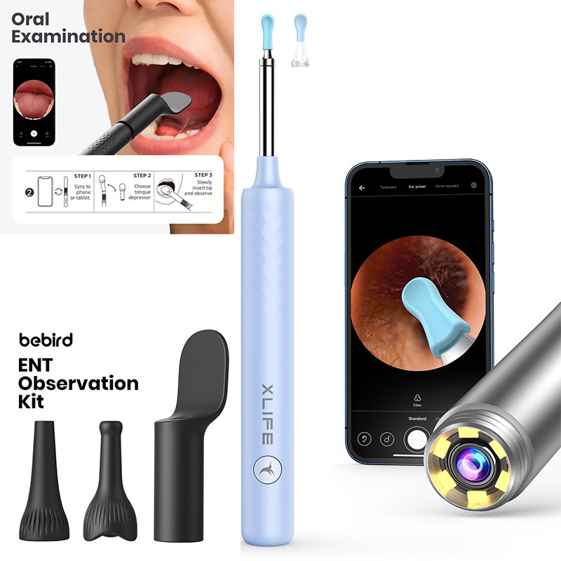 Bebird X3 Ultra Doctor's Wireless Endoscopic Examination Otitis Media Symptoms Personal Care Smart Electronic Products