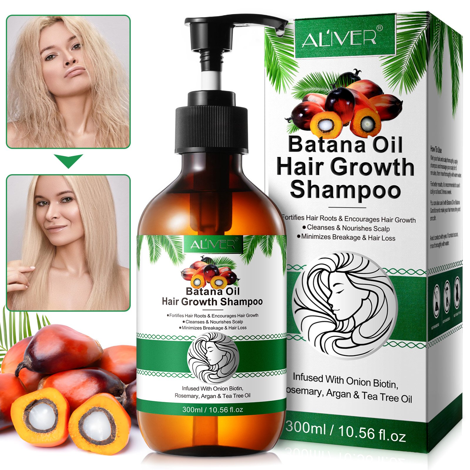 ALIVER cleanses nourishes scalp onion biotin batana oil hair growth shampoo 300ml anti hair loss batana oil shampoo