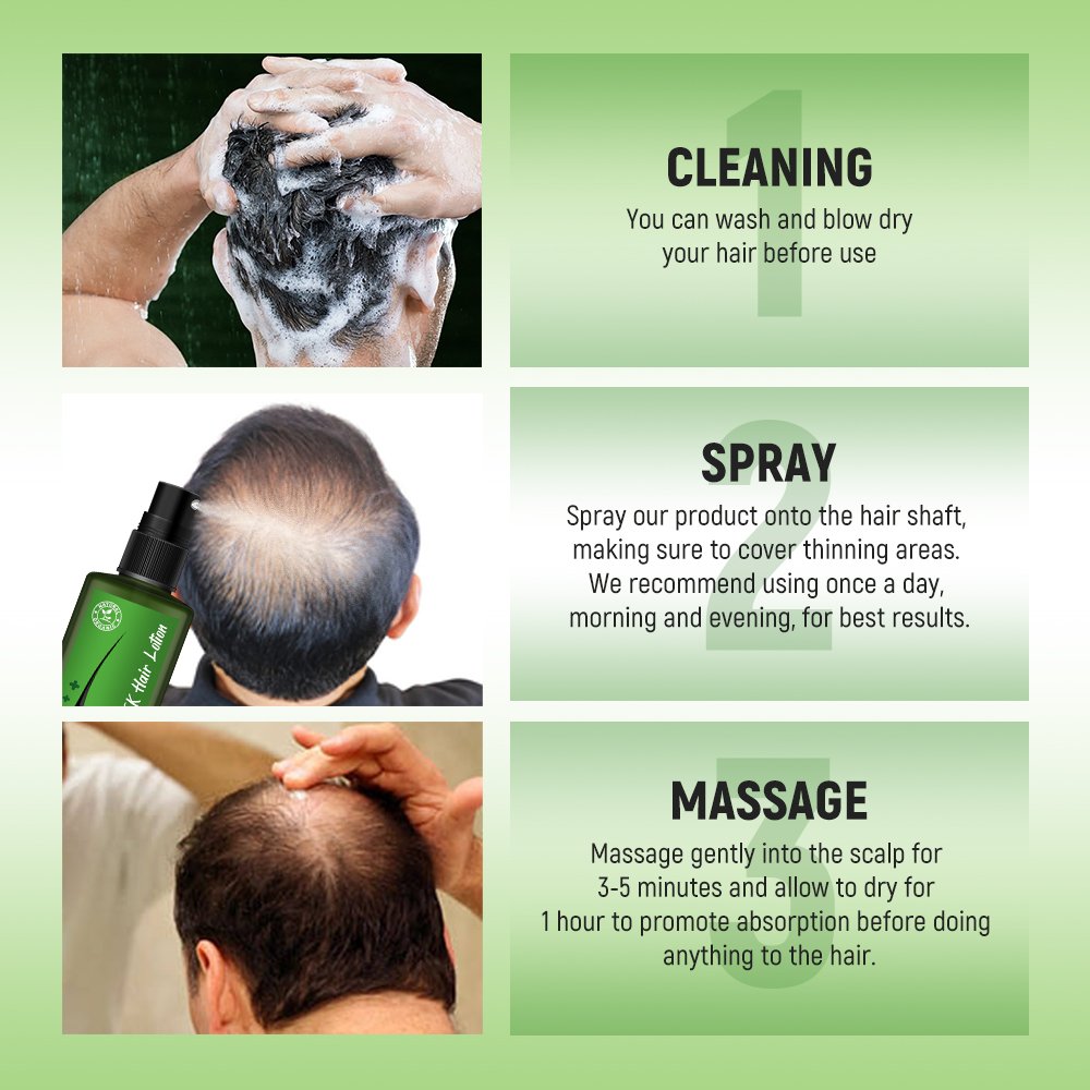 OEM 120ml promote hair regrowth treatment anti loss herbal biotin hair growth tonic spray new Dooisek hair lotion