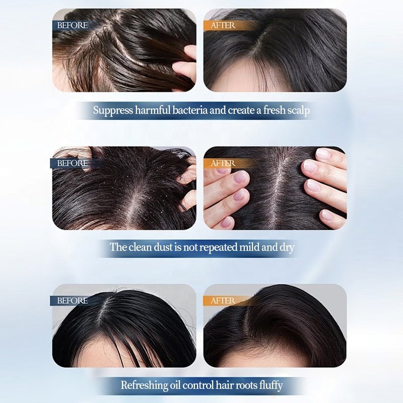Private Label Lightweight Oil Control Shampoo 500ml Volumizing Nourishing Hyaluronic Acid Zinc Pyrithione Hair Care Shampoo