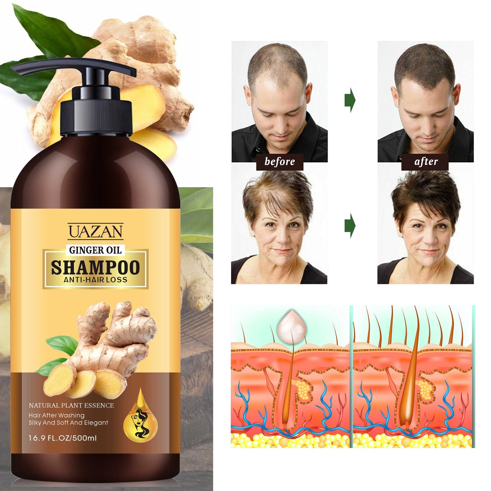 Private Label Organic Natural Herbal Ginger Stop Hair Loss Hair Growth Shampoo And Conditioner Set
