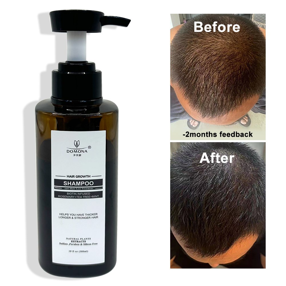 Oem manufacturer Anti Loss Stimulate Hair Regrowth Shampoo Biotin Collagen Conditioner Argan Oil