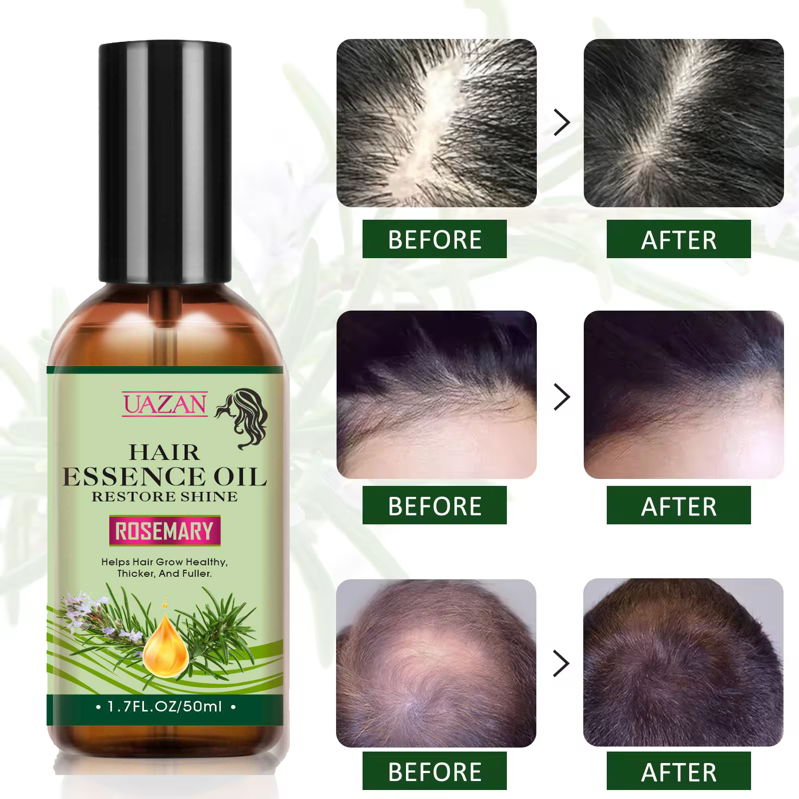 Factory OEM Best-selling Mint Rosemary Anti Hair Loss Shampoo And Conditioner Hair Serum Hair Growth Care Set