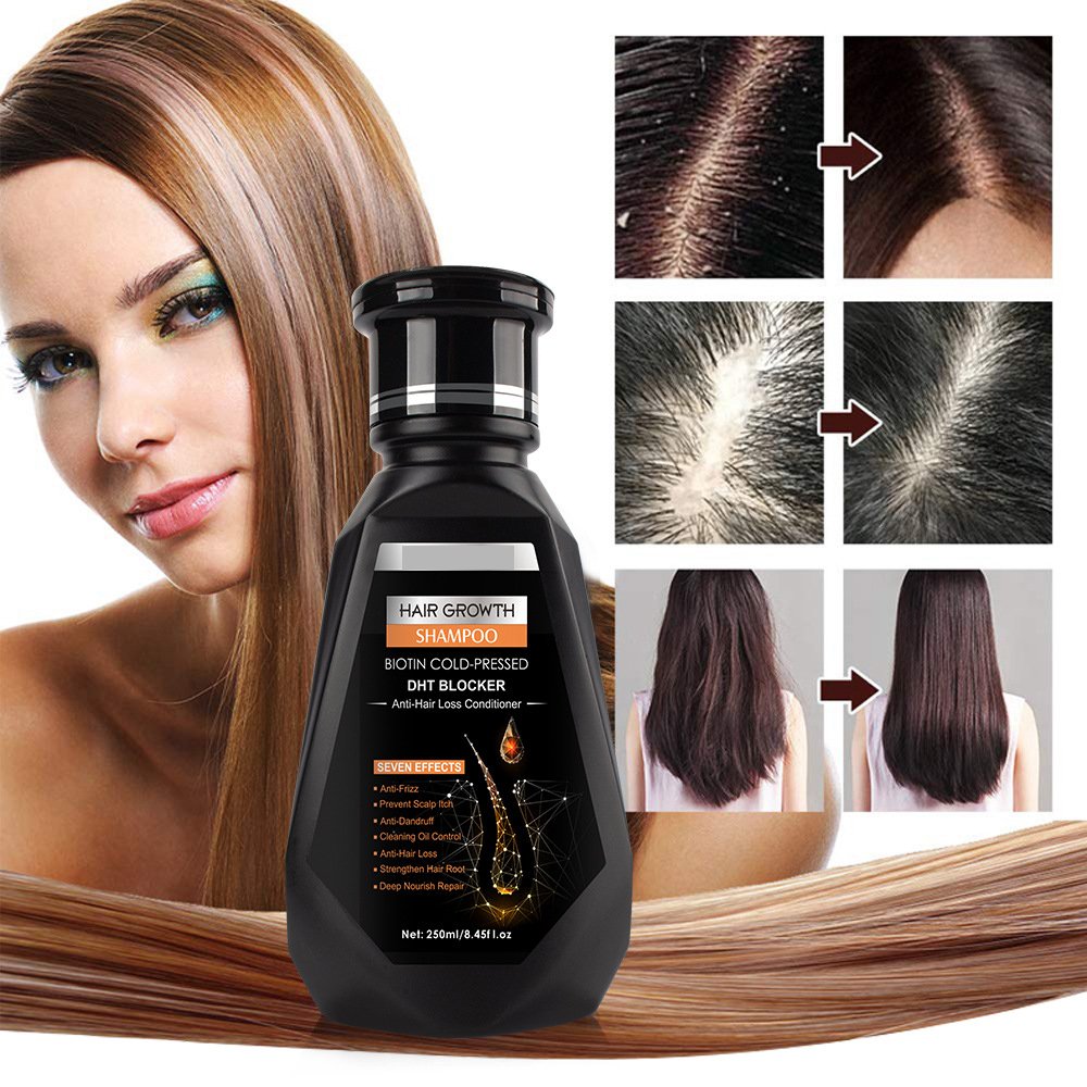 OEM own brand organic ginger shampoo supports customized ginger shampoo for hair loss, plump, smooth and strengthen hair