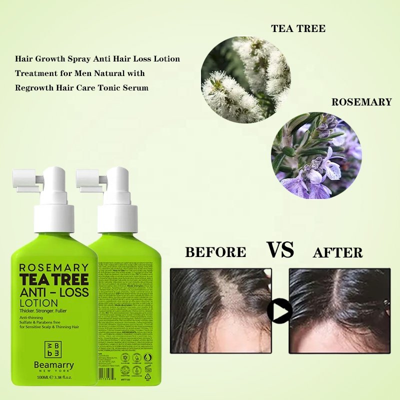 Hair Growth Spray Anti Hair Loss Lotion Treatment for Men Natural with Regrowth Hair Care Tonic Serum