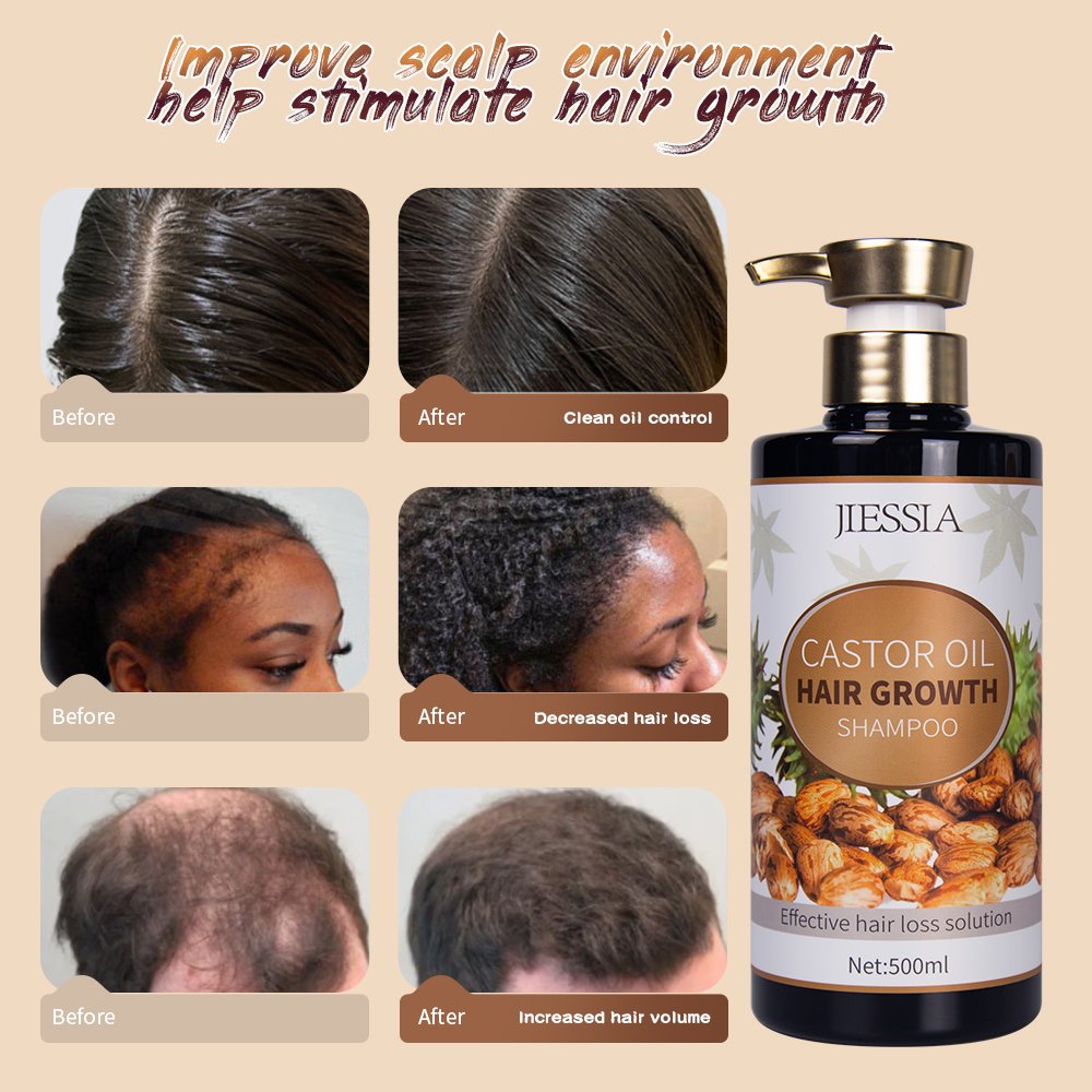 hair products wholesale natural castor oil salon cream customization hair growth shampoo