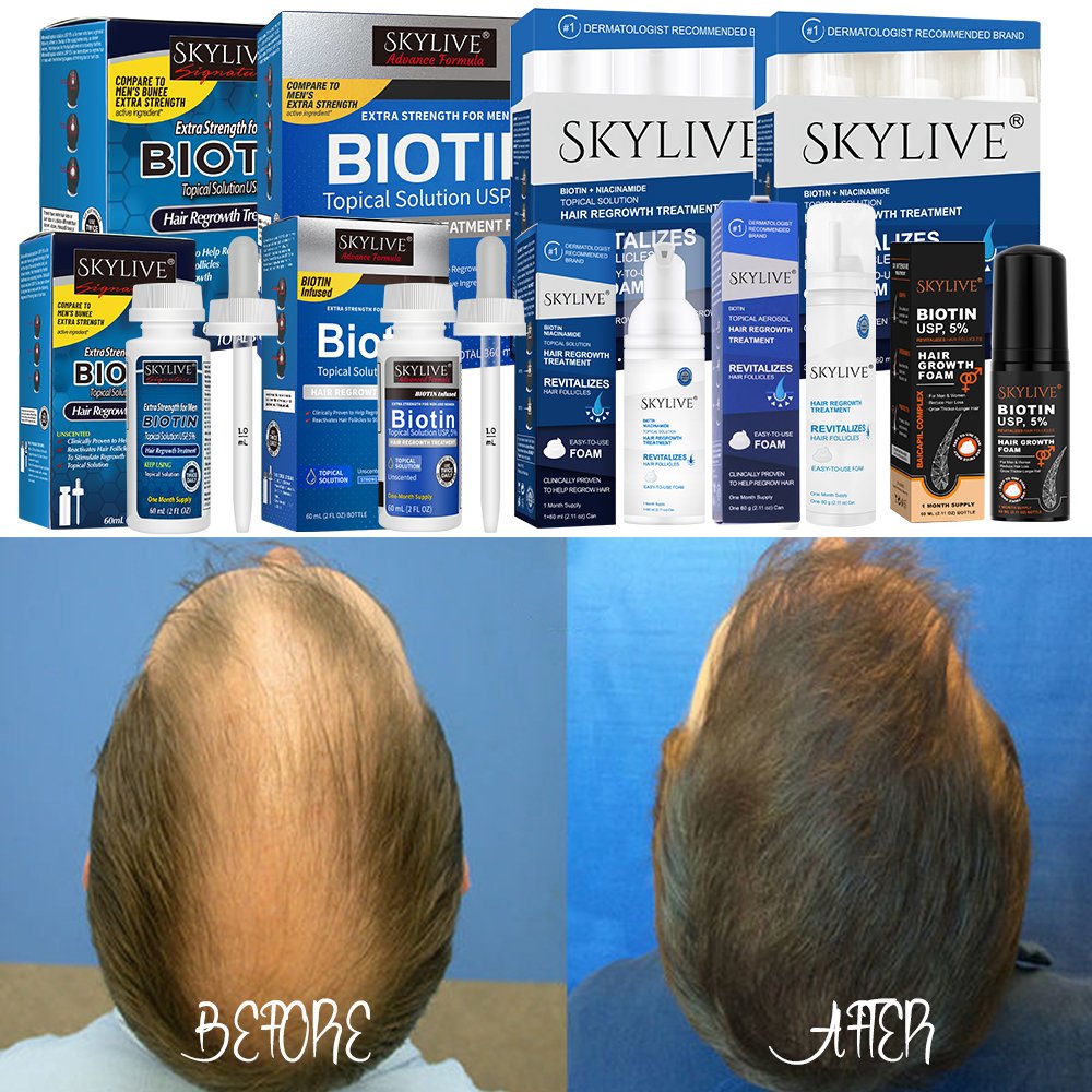 Customized Hair Regrowth Treatment Hair Growth Serum Oil Natural Organic Hair Growth Foam For Black Women Private Label