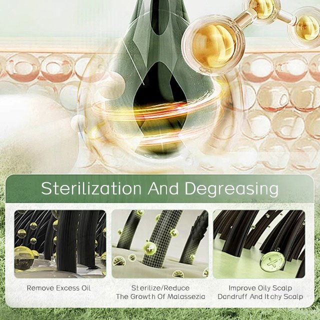 Custom Controls The Appearance Of Flakes & Relieves Scalp Anti Dandruff Shampoo For Women & Men