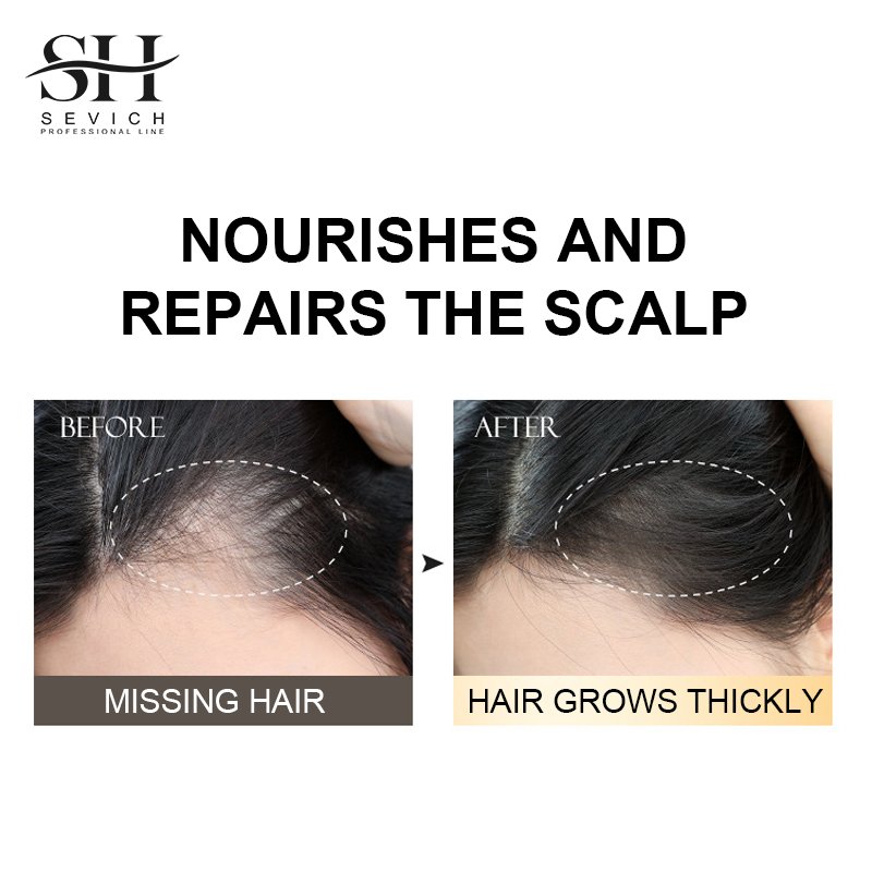 Herbal Natural Shampoo Nourishing Hair Care Products Anti Hair Loss Growth Shampoo