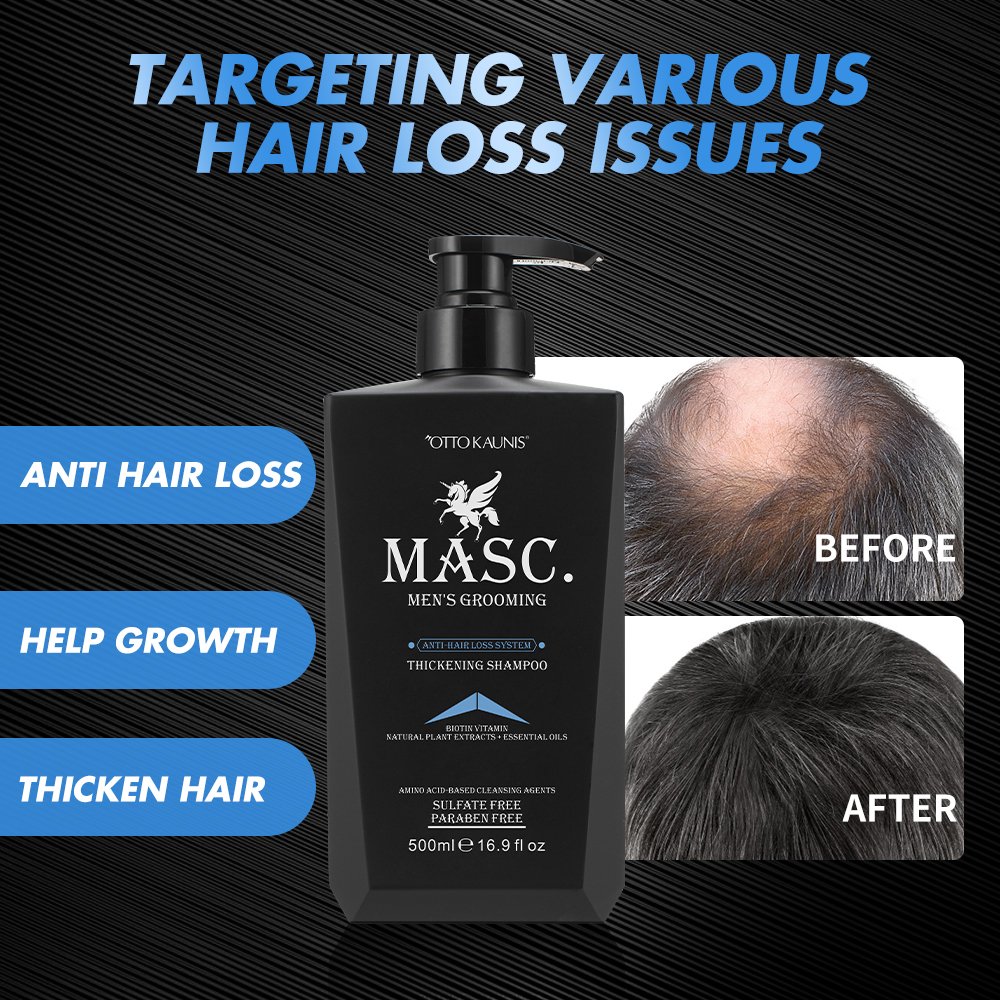 private label ginger extract sulfate free anti hair loss biotin regrowth shampoo