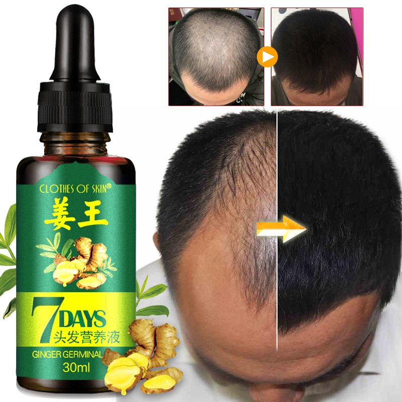 Hair treatment 7 Day Ginger Serum Scalp Damaged Treatment Prevent Hair Loss Effective Fast Growth Massage Liquid 30ml GG