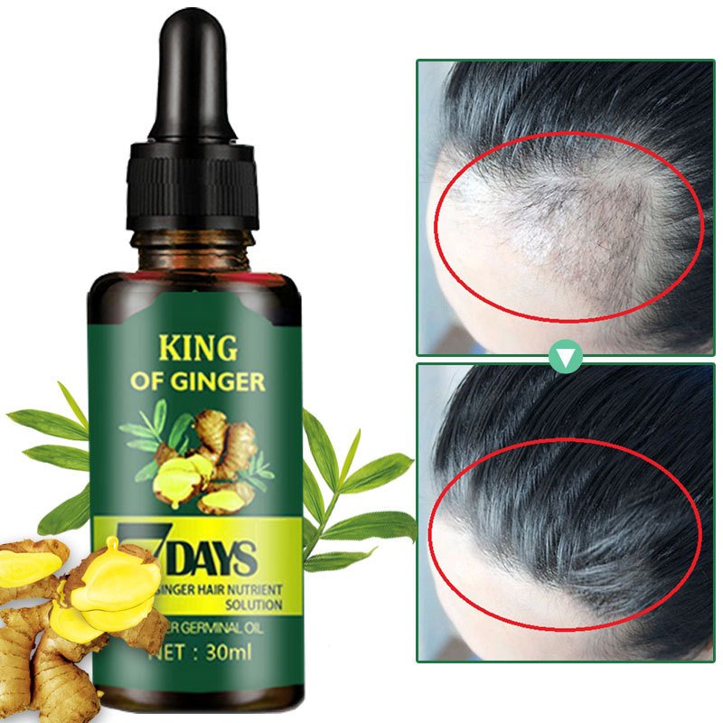 Hair treatment 7 Day Ginger Serum Scalp Damaged Treatment Prevent Hair Loss Effective Fast Growth Massage Liquid 30ml GG