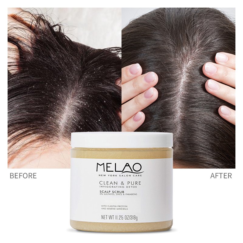 MELAO 100% Pure Natural Exfoliating Hair Massager Scrub Hair Wash Sea Salt Shampoo Scalp Scrub Exfoliator