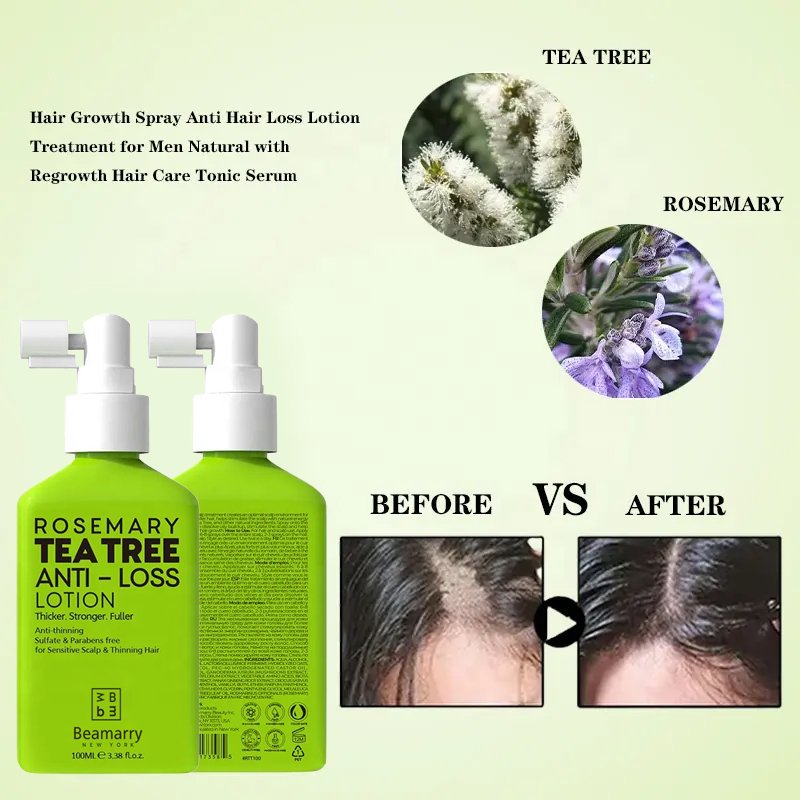 Natural Fast Grow Hair Oil Hair Loss Lotion Care Growth Spray Beauty Hair & Scalp Treatment For Men Women 100ml