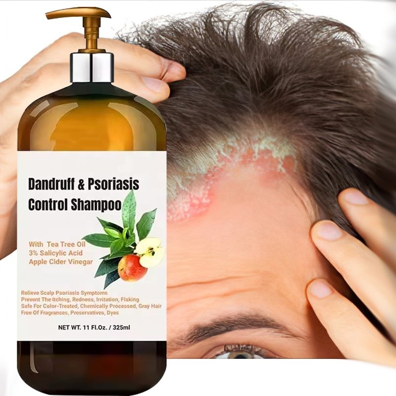 Eczema Psoriasis Shampoo 3% Salicylic Acid Anti-Dandruff Seborrheic Dermatitis Relieve Scalp Treatment Folliculitis Hair Shampoo