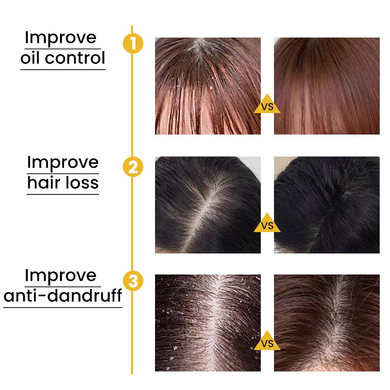 OEM Private Label 100% Natural Organic Ginger Extracts Shampoo Oil Control Ginger Shampoo for Oily Hair
