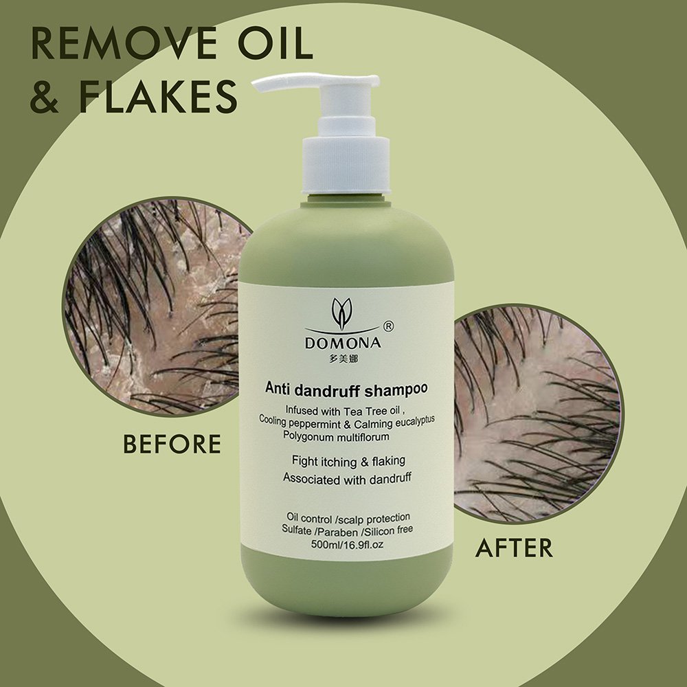 OEM Peppermint Essential Extract Oil Shampoo Preven Anti Dandruff Tea Tree Conditioner Lotion Christmas