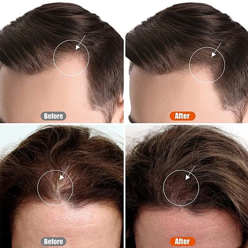 organic fast-growing ginger shampoo private label anti-hair loss shampoo reduces hair loss moisturizing and smoothing