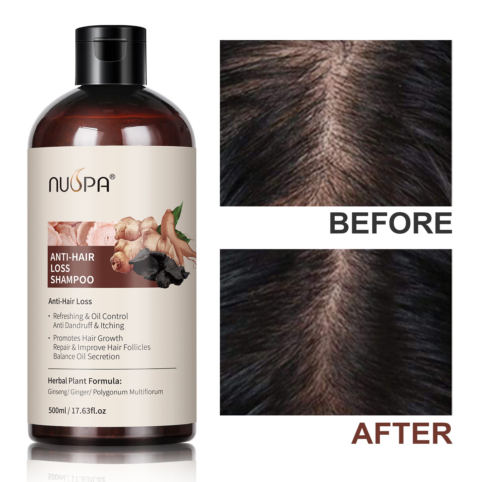 Factory Sale Vegan Ginger Hair Care Set Organic Hair Growth Serum Herbal Anti Hair Loss Shampoo