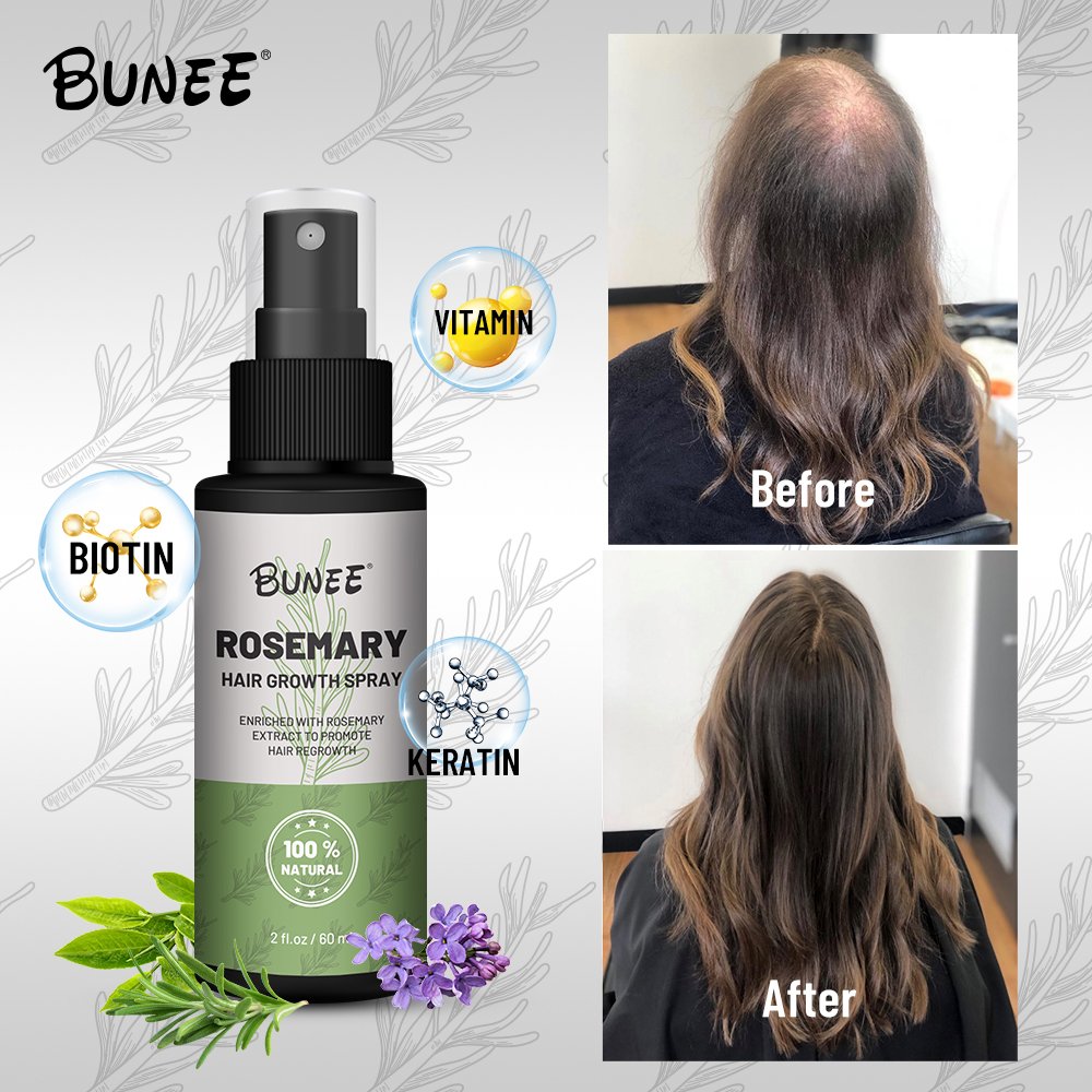 Hot sale rosemary hair growth liquid spray hair loss treatments eaasential oil serum hair regrowth tonics