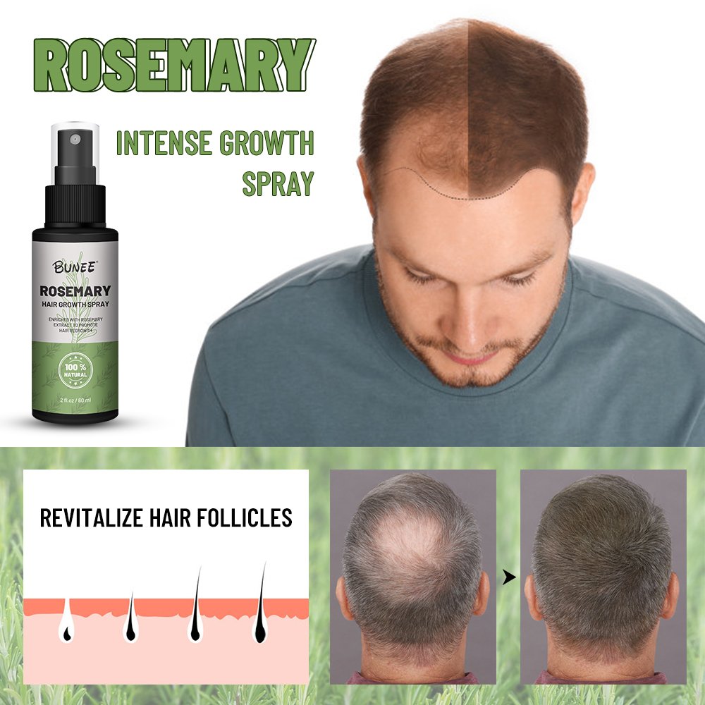 Hot sale rosemary hair growth liquid spray hair loss treatments eaasential oil serum hair regrowth tonics
