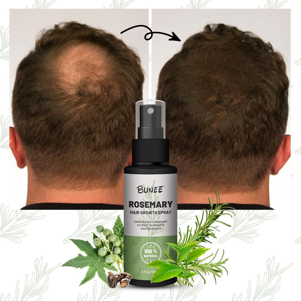 Hot sale rosemary hair growth liquid spray hair loss treatments eaasential oil serum hair regrowth tonics